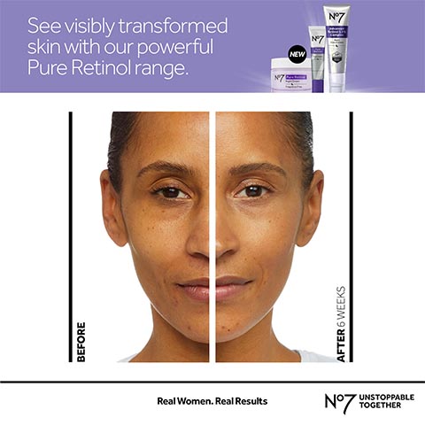 Tretinoin cream for under-eye treatment.