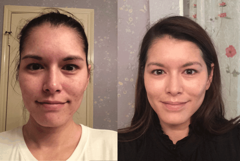 Tretinoin cream for anti-aging skin treatment.