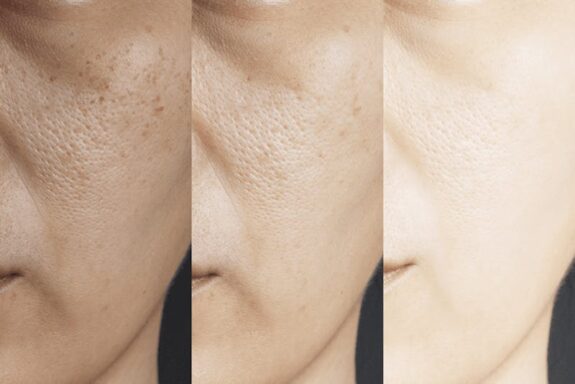 Hydroquinone & Retinol serum, skincare product.