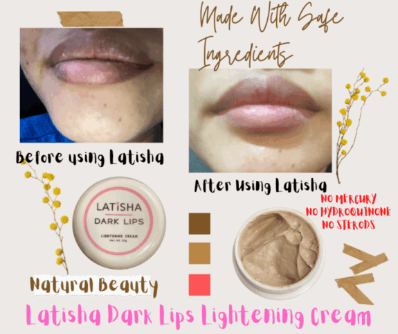 Hydroquinone cream for dark lips.
