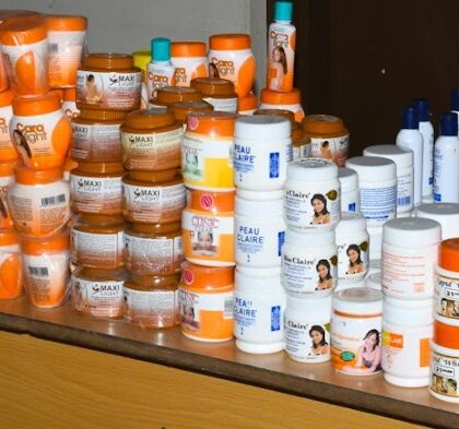 Hydroquinone skin lightening lotions.