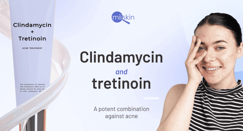 Tretinoin and Clindamycin Cream. Acne treatment.