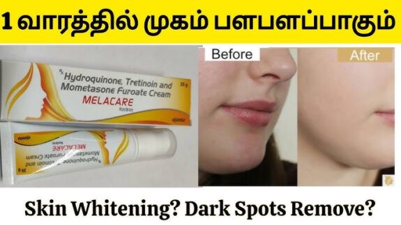 Hydroquinone Tretinoin Mometasone Furoate Cream tube