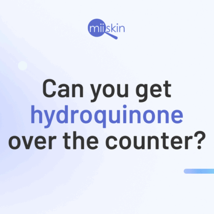 Over-the-counter hydroquinone cream.