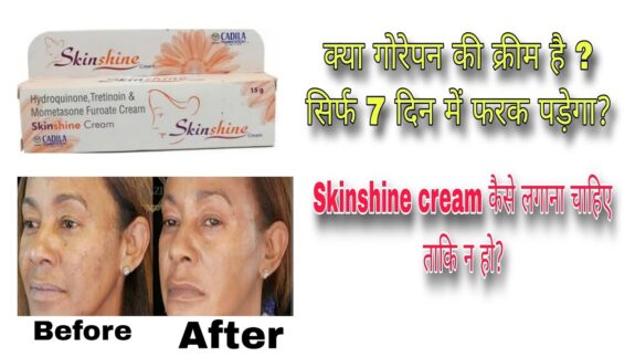 Hydroquinone Tretinoin Mometasone Furoate Cream