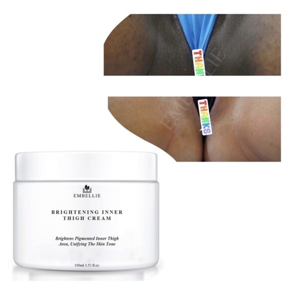 Hydroquinone cream for dark inner thighs.
