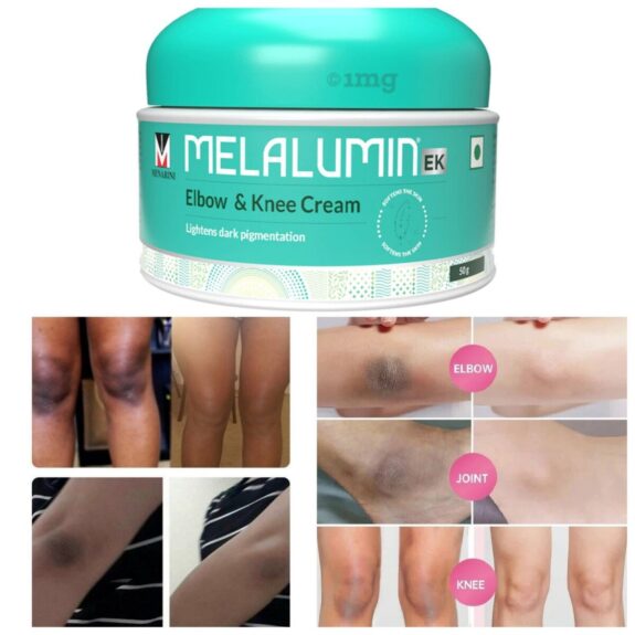 Hydroquinone Cream 1mg
