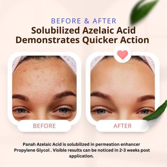 Azelaic Acid Skin Lightening serum bottle