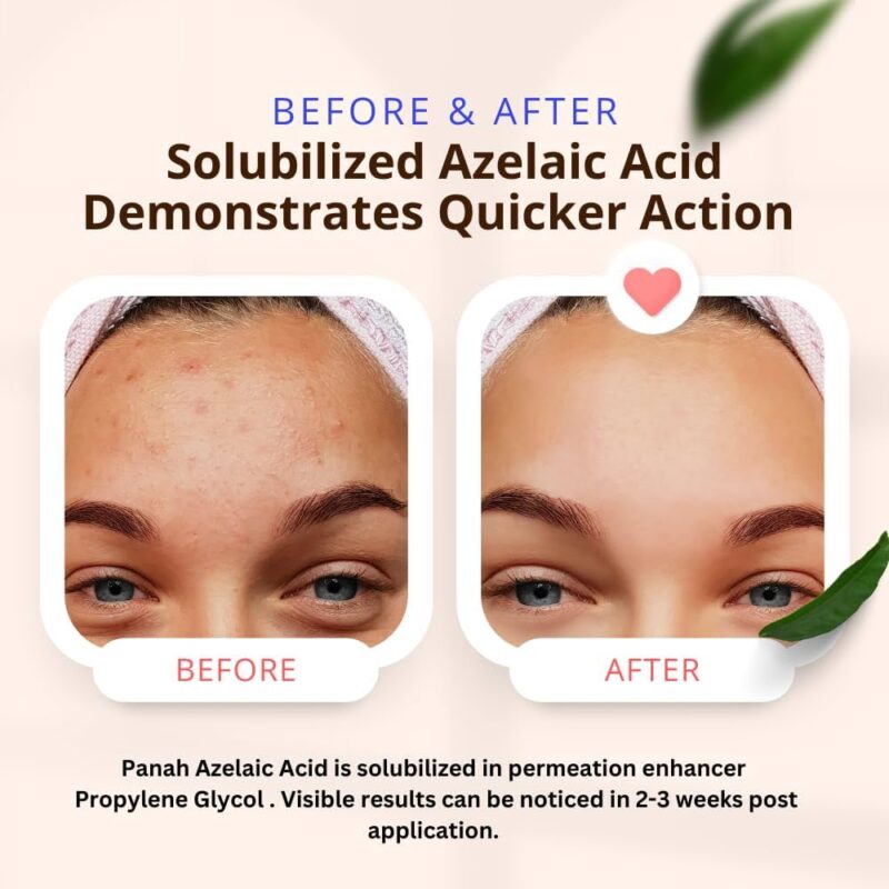 Azelaic Acid Skin Lightening serum bottle