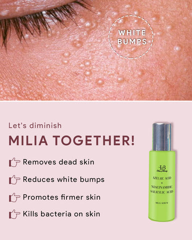 Azelaic Acid Milia treatment serum.