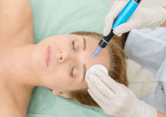 Azelaic Acid serum for post-microneedling skin recovery.