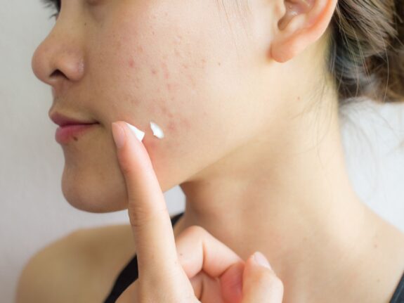 Azelaic acid spot treatment serum bottle