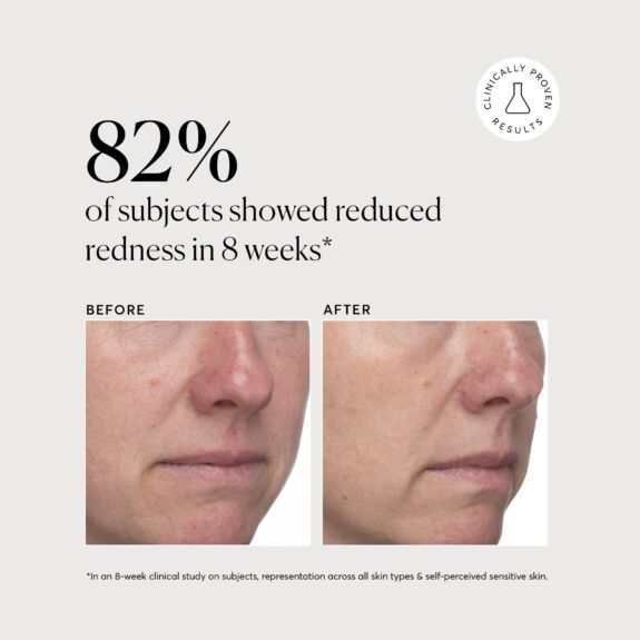 Azelaic Acid serum following Niacinamide application.