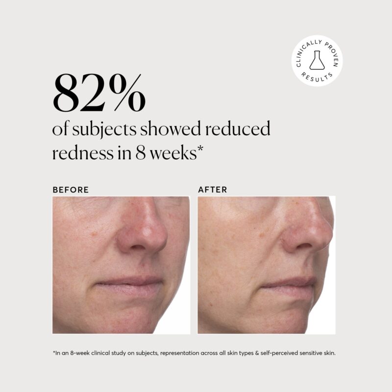Azelaic Acid serum following Niacinamide application.