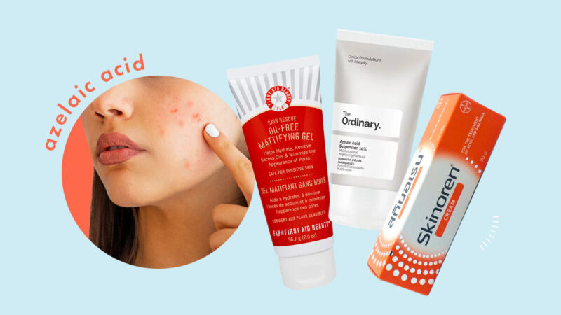 Skinoren Cream: Gentle treatment for sensitive skin.