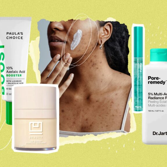 Azelaic Acid Cream for Pregnancy: Soothing skincare.