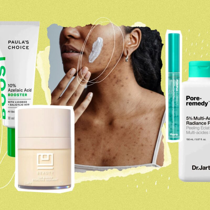Azelaic Acid Cream for Pregnancy: Soothing skincare.